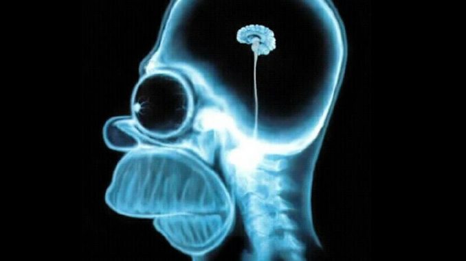 homers-brain